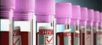  HIV Testleri Nelerdir? Bulaş Riskinden Sonra   Ne Zaman Yaptırabilirim?